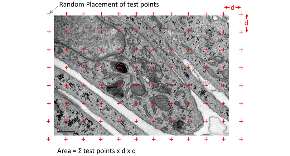 TEM techniques Stereology.