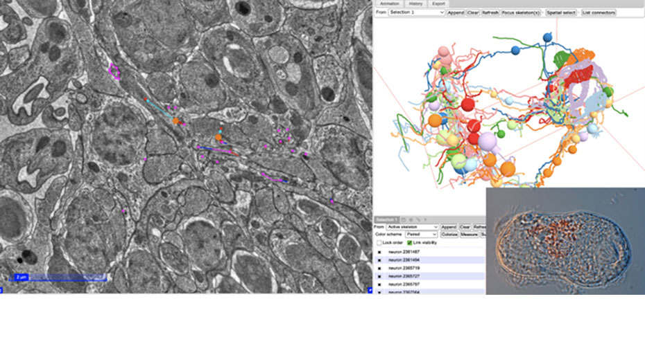 TEM techniques array tomography