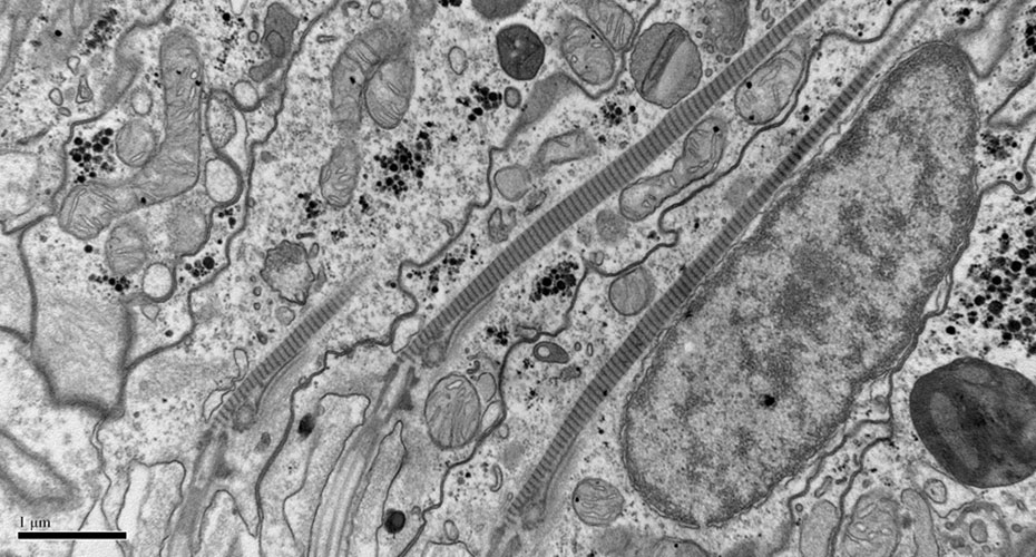 Transmission Electron Microscopy image showing Conventional resin-embedding  techniques