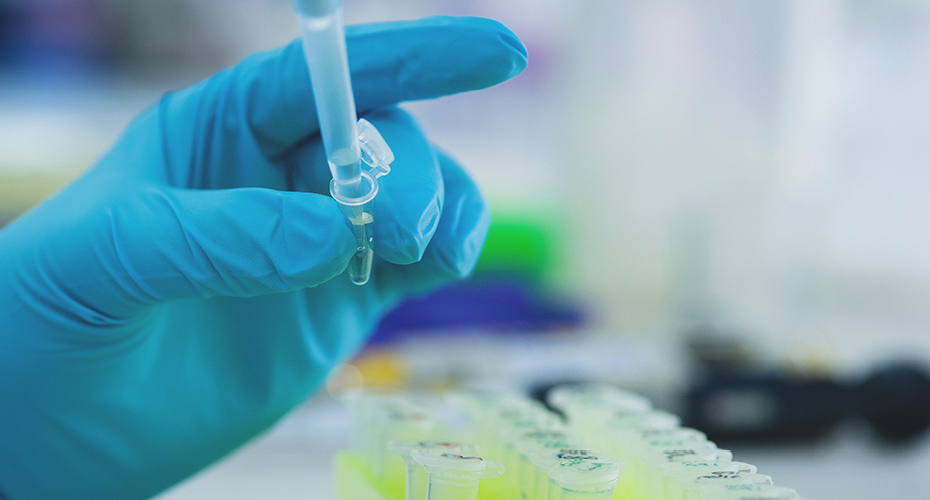 Gloved hand with pipette