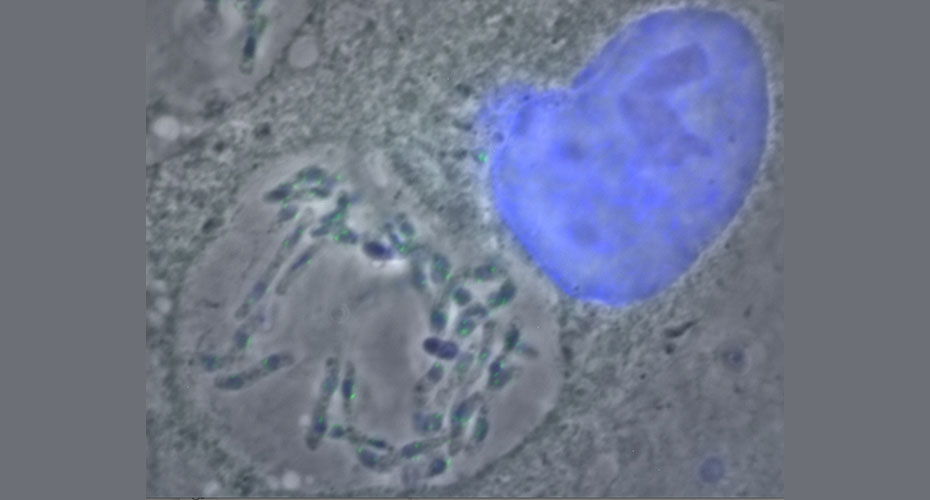 Graphic of microbe